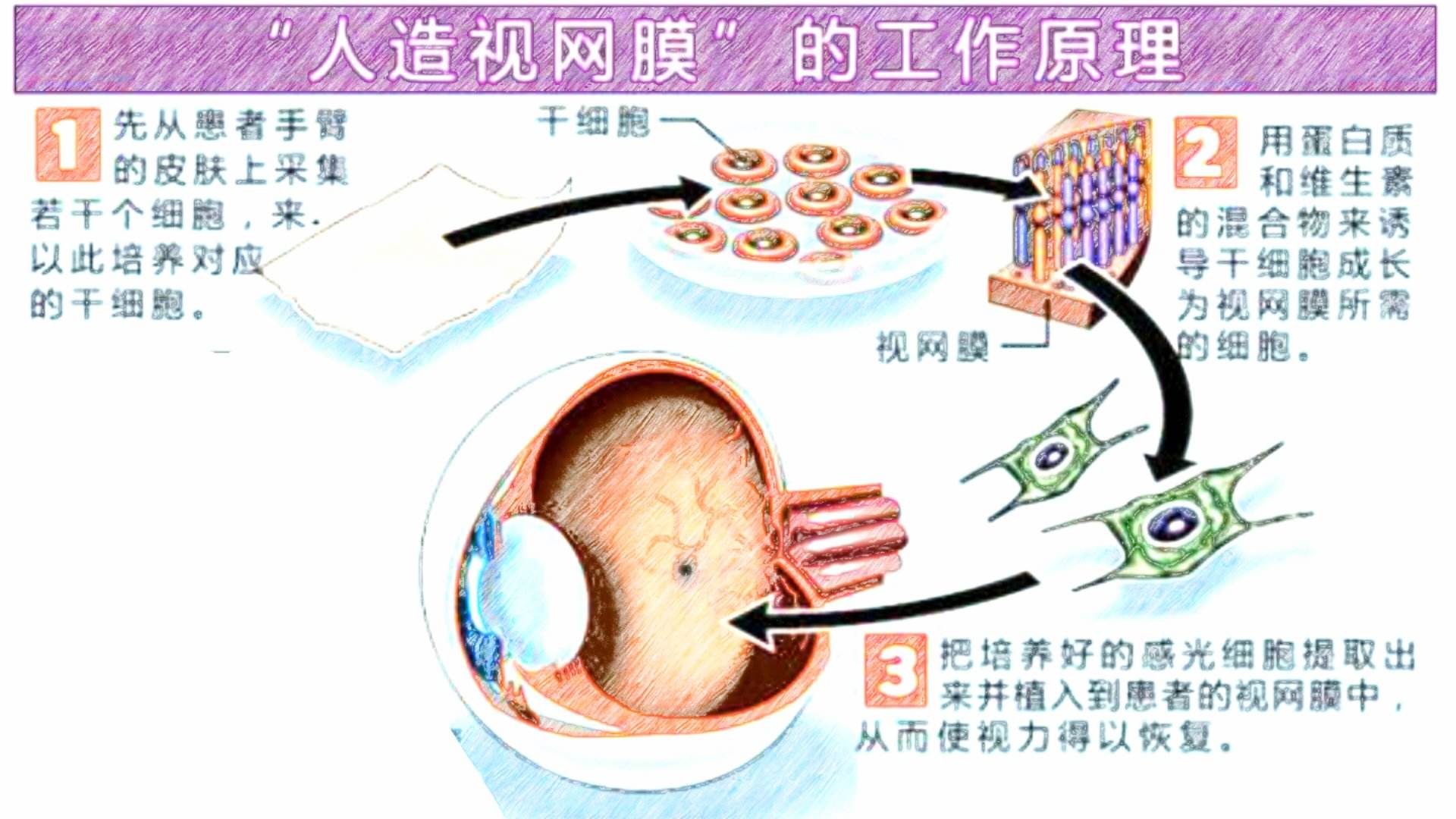 最新人造器官技术，重塑生命的未来之路