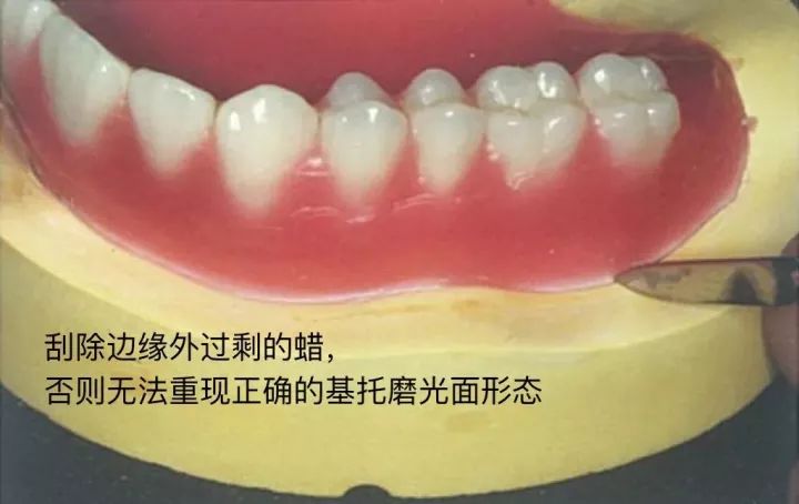 最新型义齿，重塑口腔健康的新里程碑