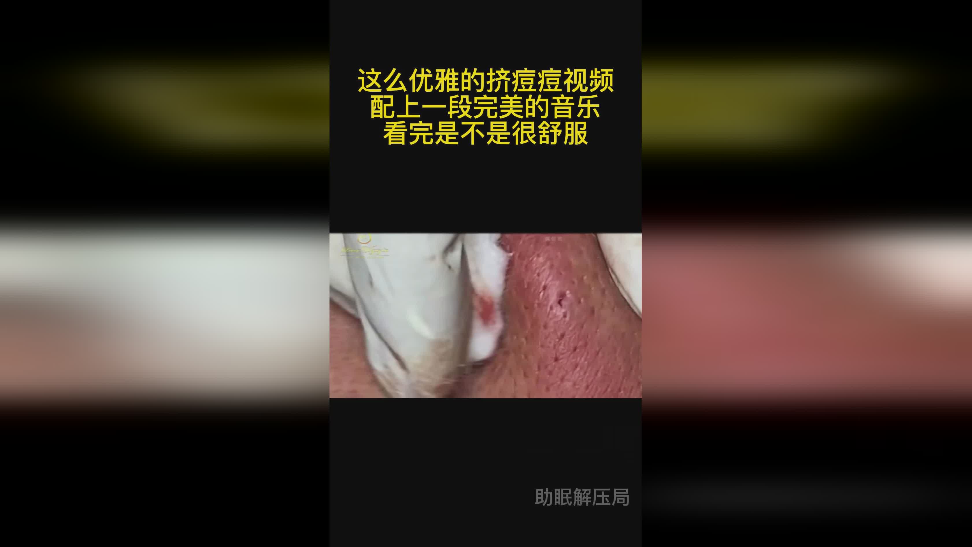 挤豆视频最新动态，探究短视频领域的创新与发展及其影响